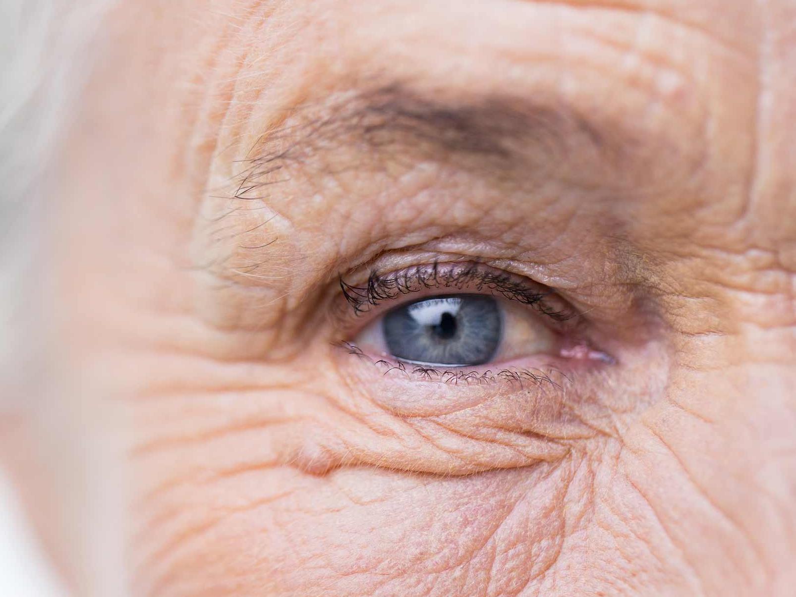 Billedet viser et usundt øje tæt på, der illustrerer risiko for potentiel okulære adnixa. 