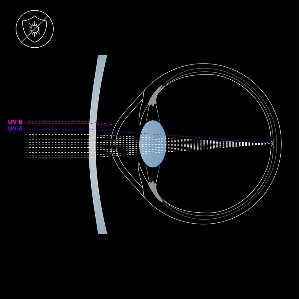 Illustration af øjet og et brilleglas uden UV-beskyttelse, som transmitterer UVA- og UVB-stråler ind i øjet.  