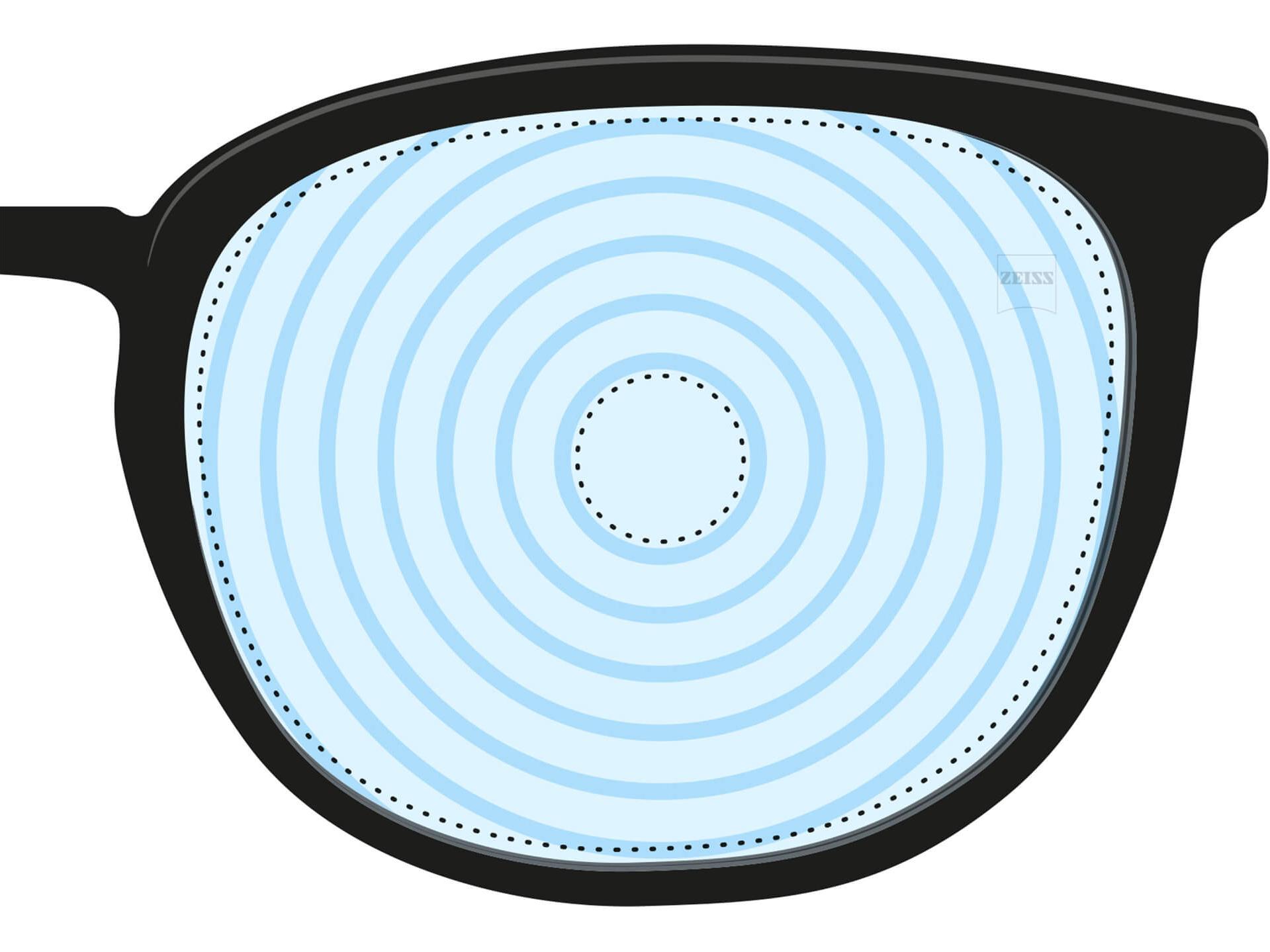 En illustration af et brilleglas til behandling af myopi. Det har koncentriske cirkler, der repræsenterer de forskellige glasstyrker. Det er et eksempel på et brilleglasdesign til et bestemt formål.