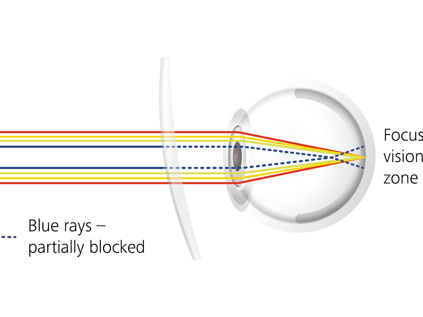 Illustration af hvordan brilleglas-coating kan reducere blænding ved delvist at blokere for blåt lys 